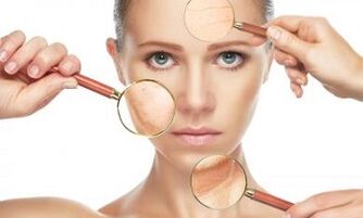 what skin problems are solved by fractional laser rejuvenation