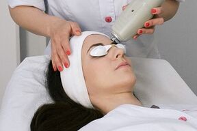 performing a laser fractional recovery procedure